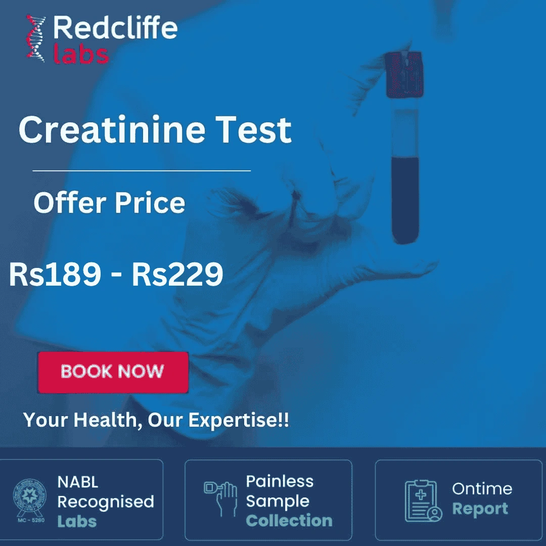 Creatinine Test Price