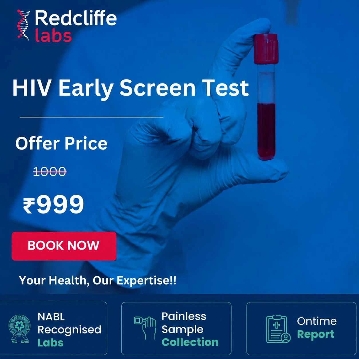 HIV Test price