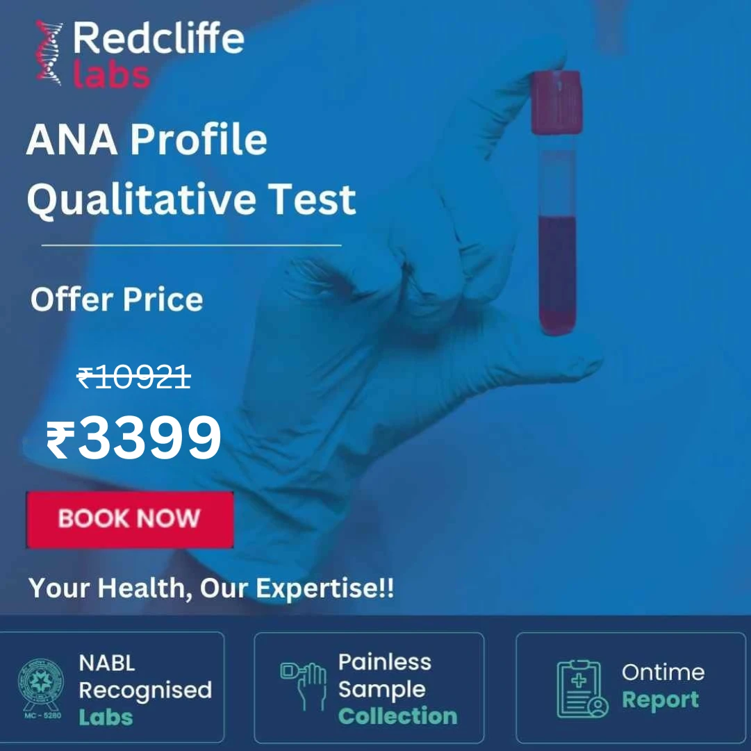 ANA Profile Test Price