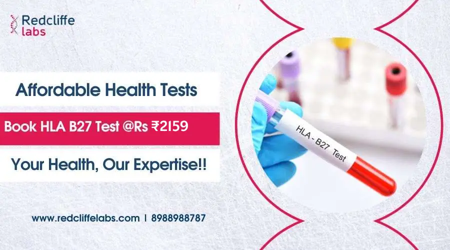 HLA B27 Test Price