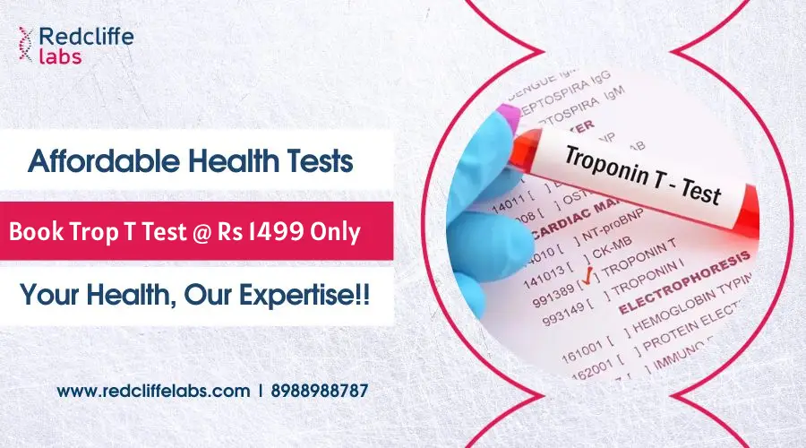 Troponin T Test Price