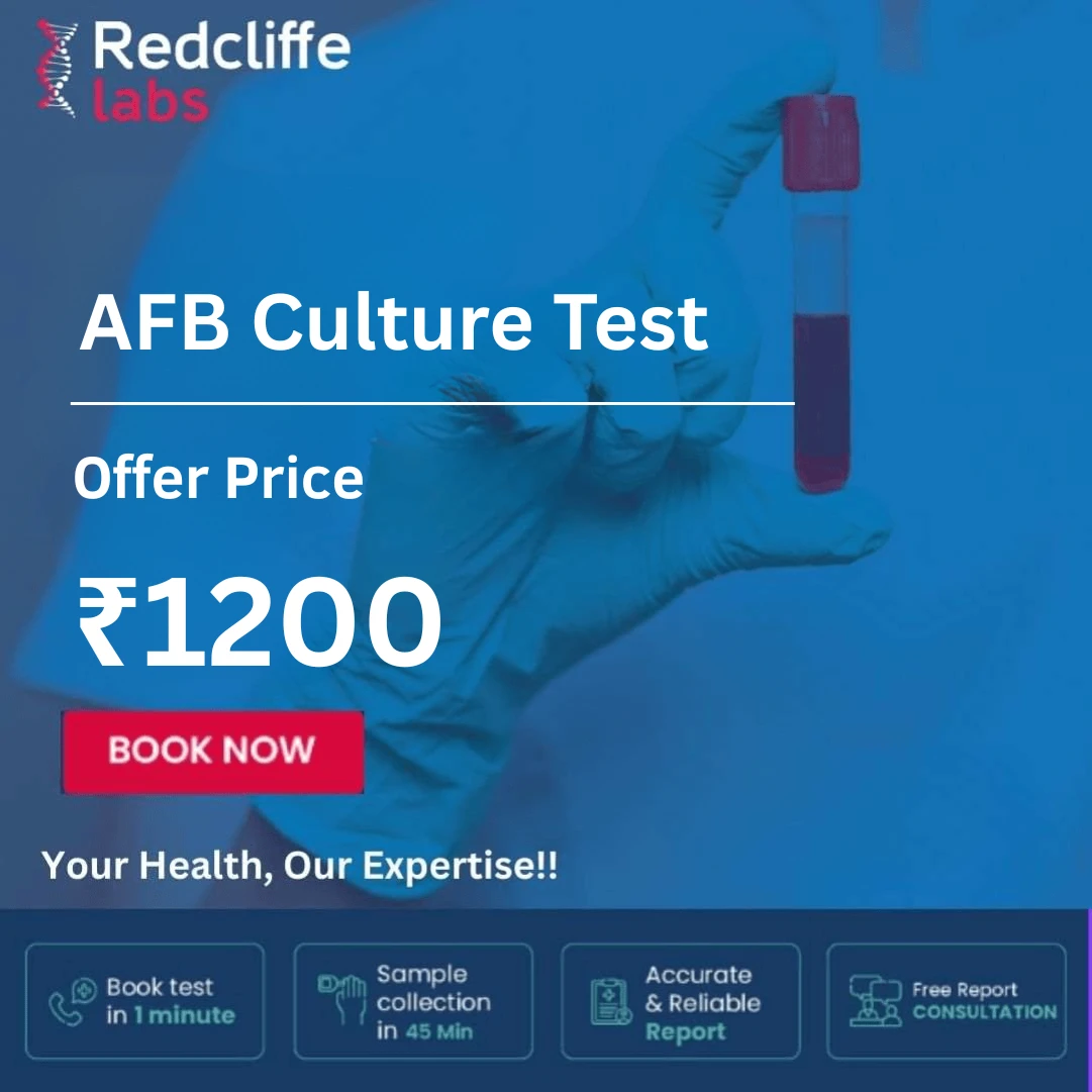 AFB Culture Test Price