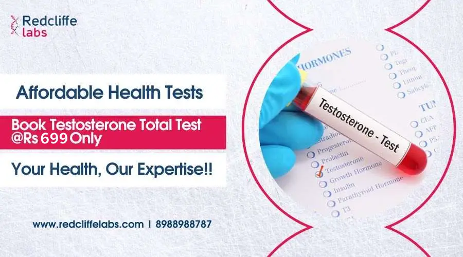 Testosterone Test Price