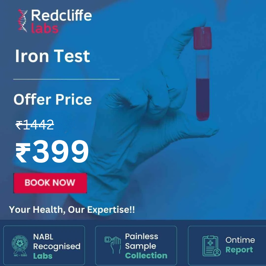Iron Test Price
