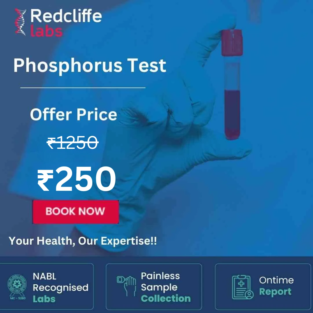Phosphorus test price