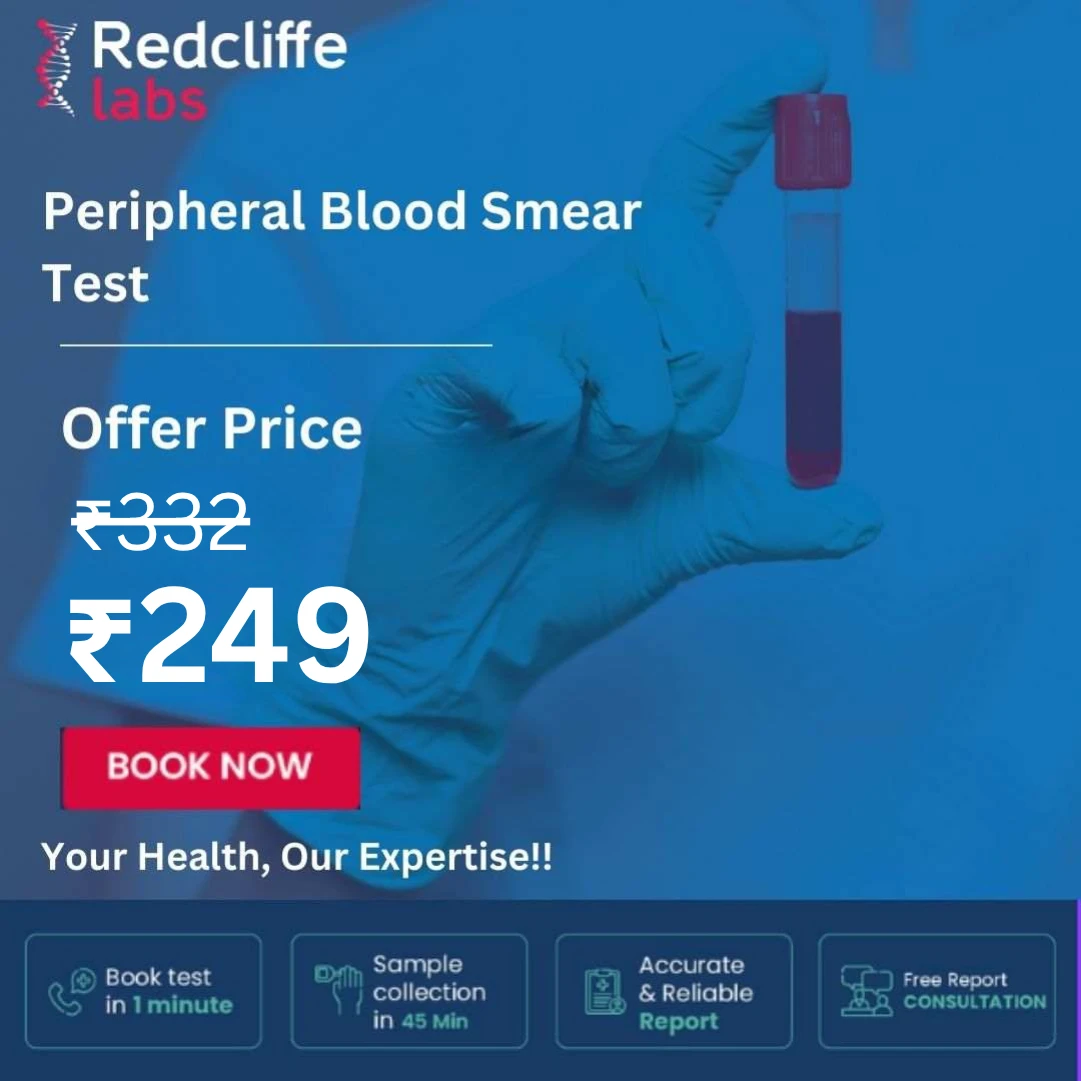Peripheral Blood Smear Test Price