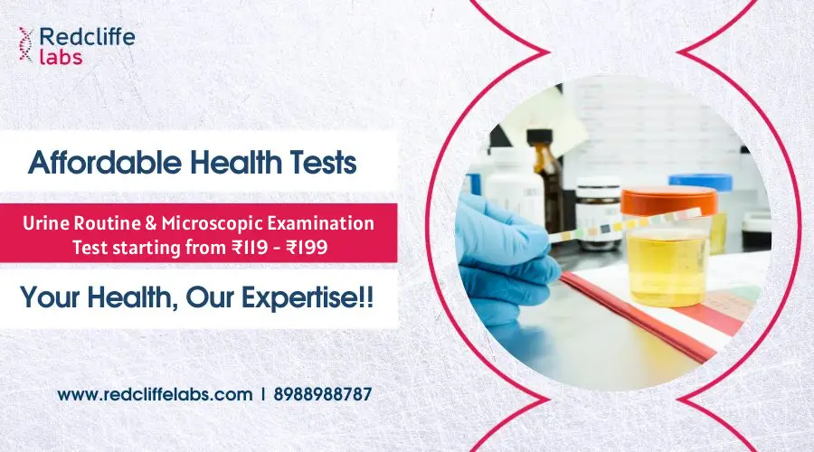 Urine Routine Test price in Hyderabad