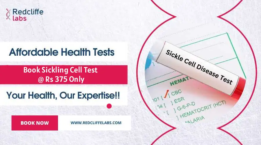 Sickling cell Test Price