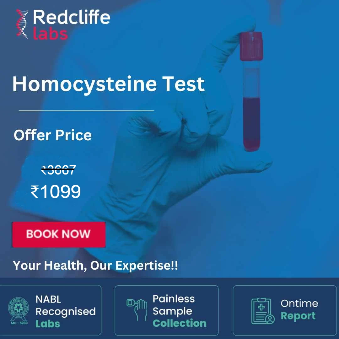 Homocysteine Test Price in Indore