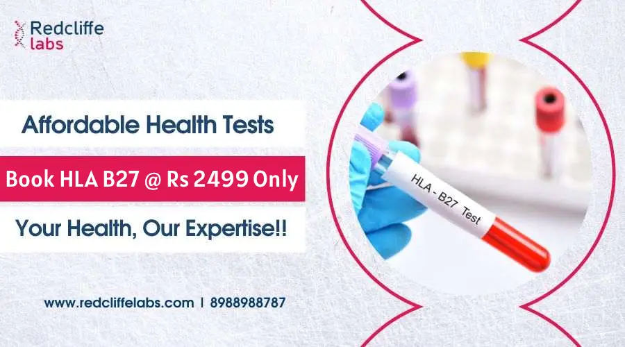 HLA B27 Test Price