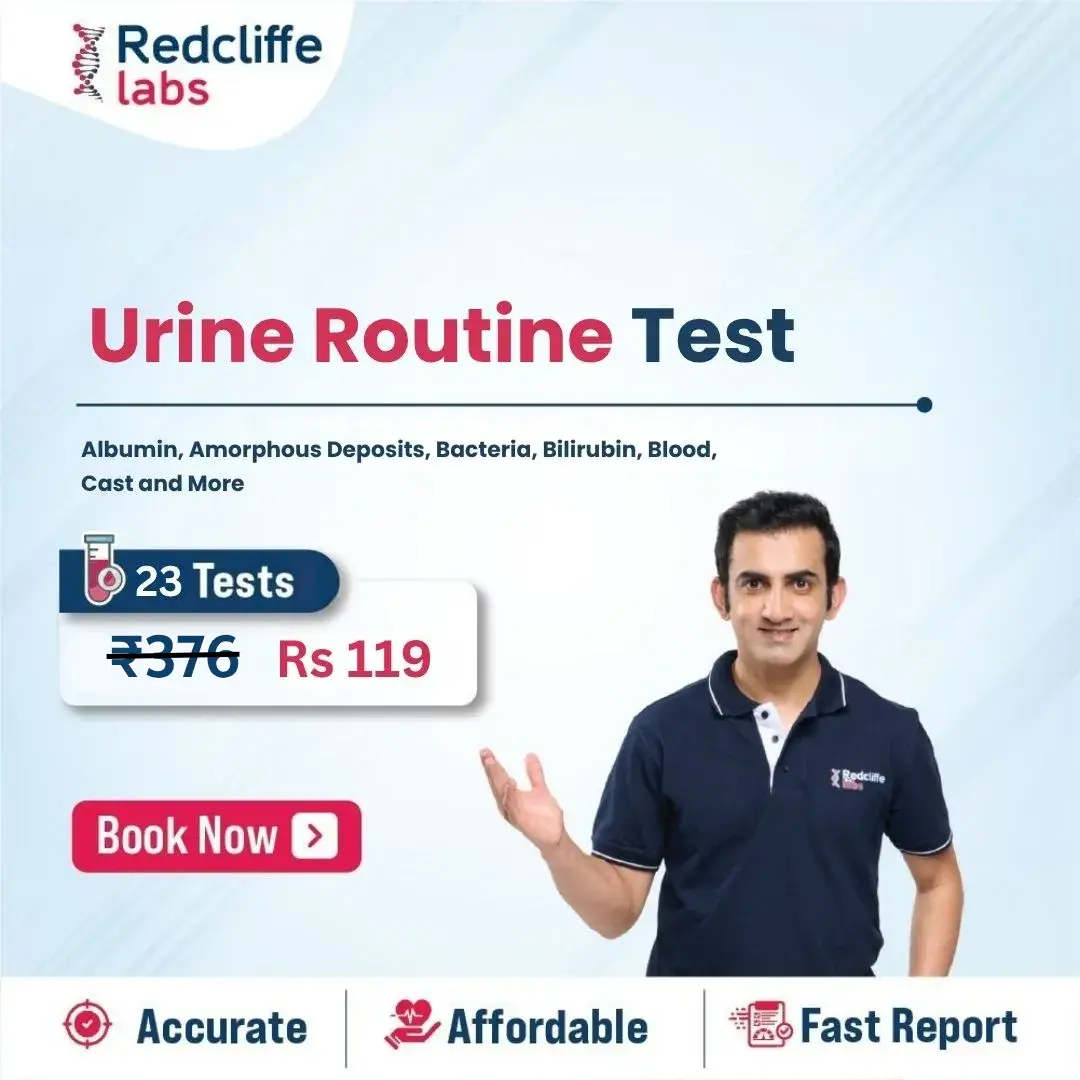 Urine Routine Test price in Faridabad