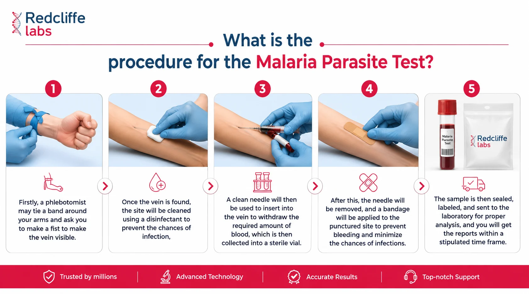 procedure of malaria test
