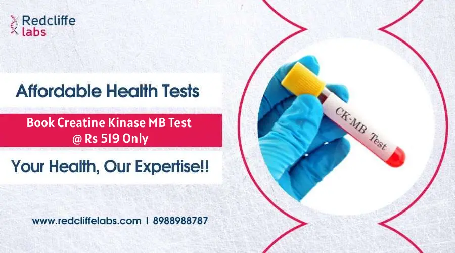 CK MB Test Price