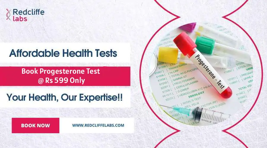 Progesterone Test Price