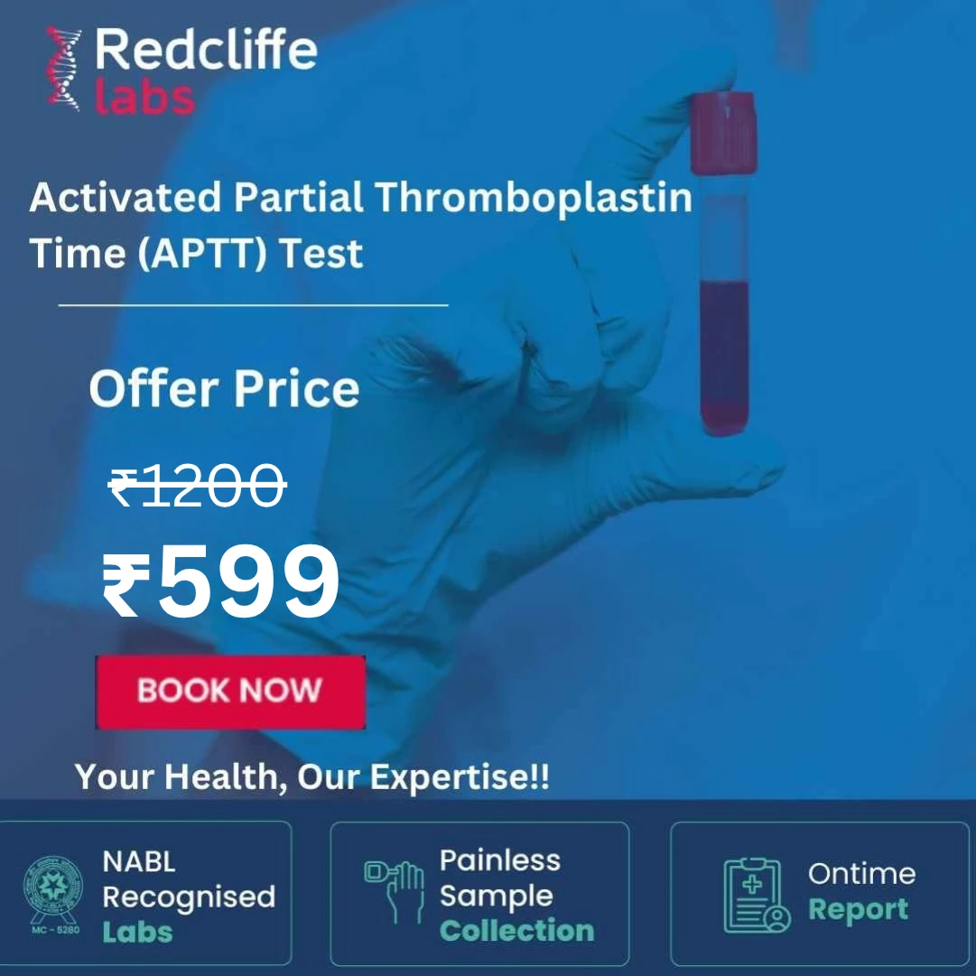 APTT test price