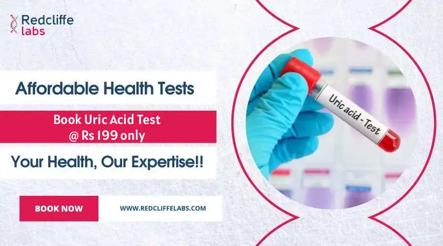 Uric Acid Test Price in Delhi