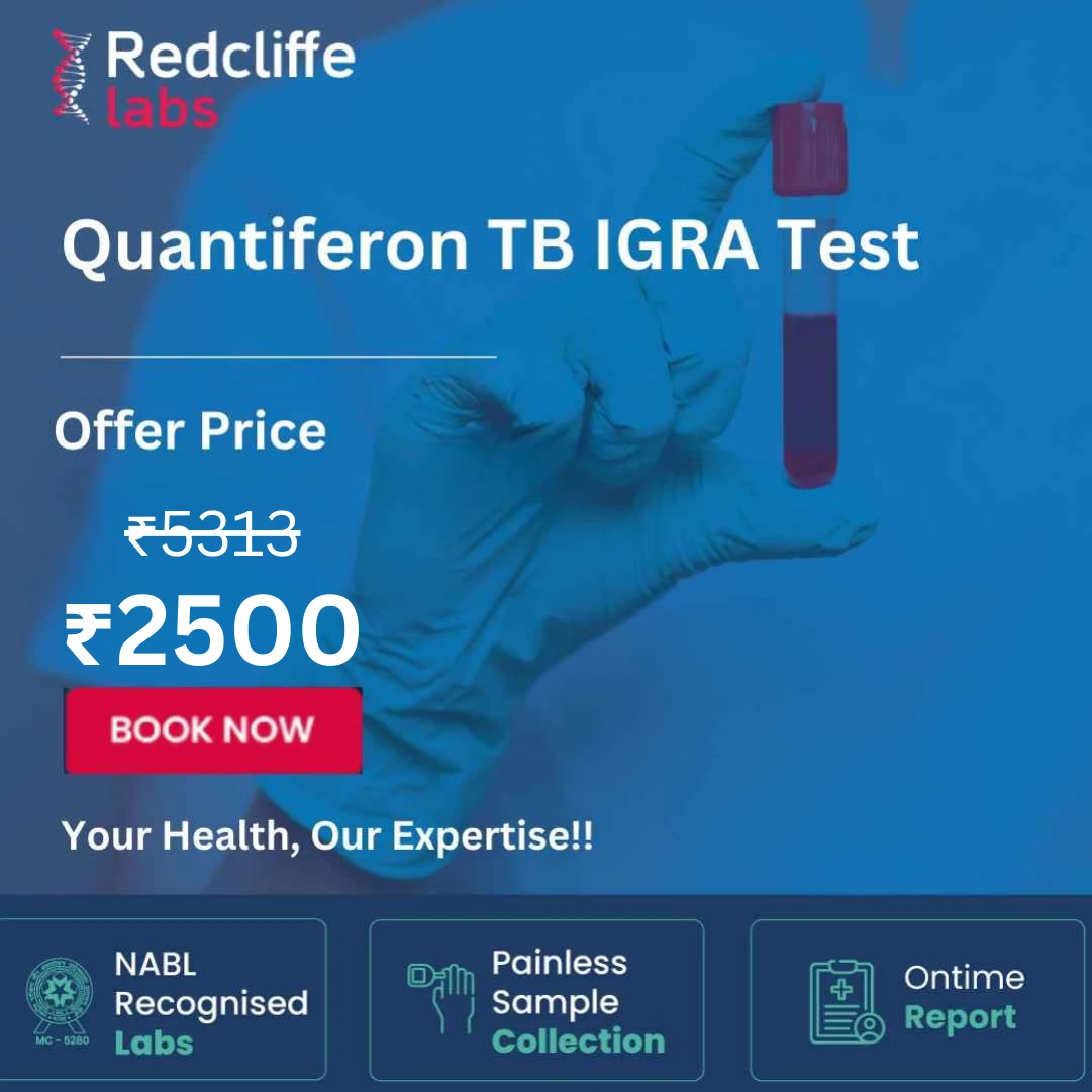 TB Igra test price
