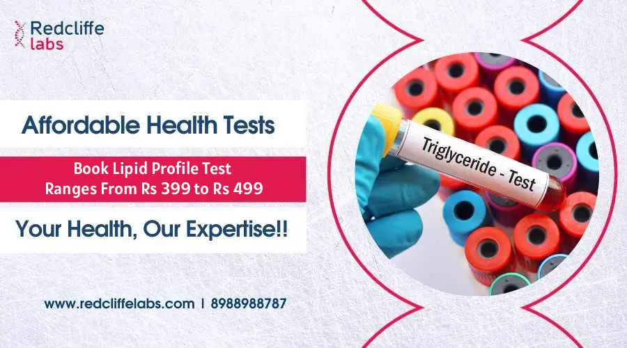 Lipid Profile Test Price