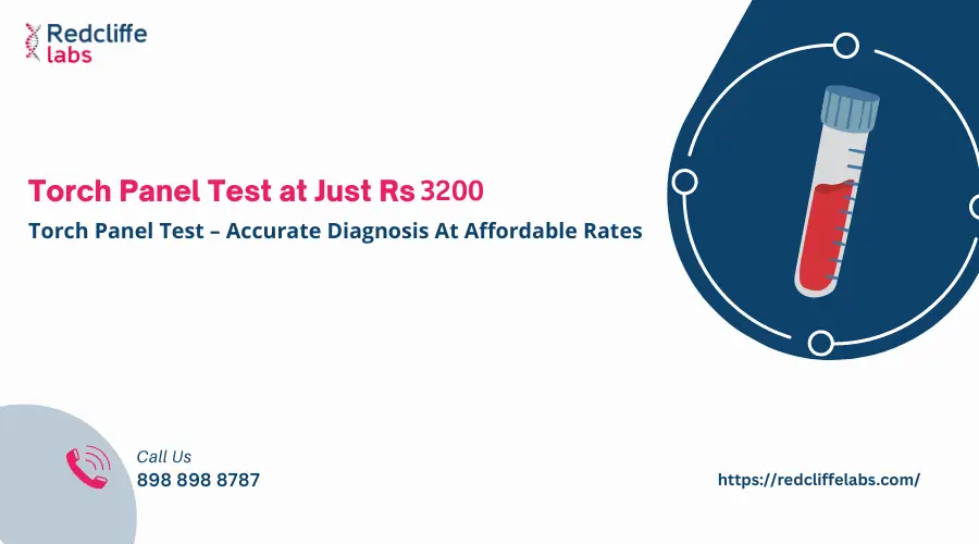 Torch Panel Test Price